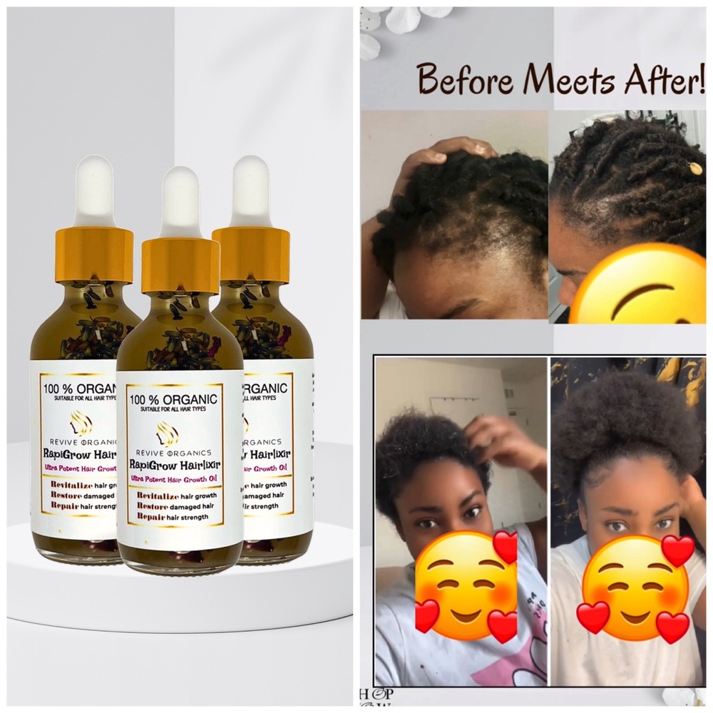 Organic hair growth oil 2oz hanmade